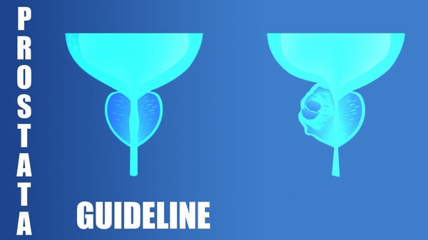 Curare il Tumore della Prostata - Linee Guida 2025