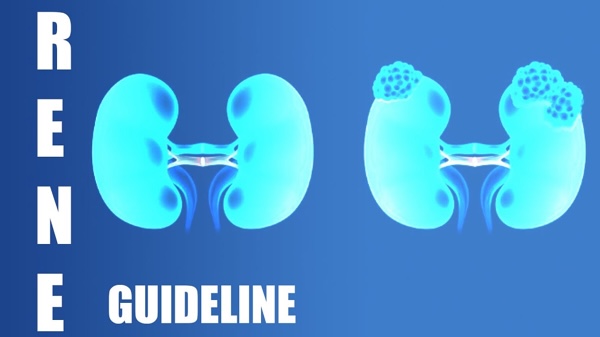 Curare il Tumore del Rene - Linee Guida 2025